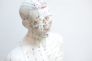 acupuncture, cerebral palsy