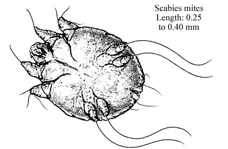 scabies, mite, bug, microscopic