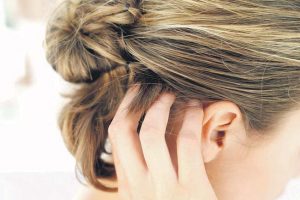 Home Remedies For Hair Dye Allergies