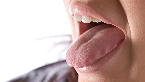 Home Remedies for a Burnt Tongue